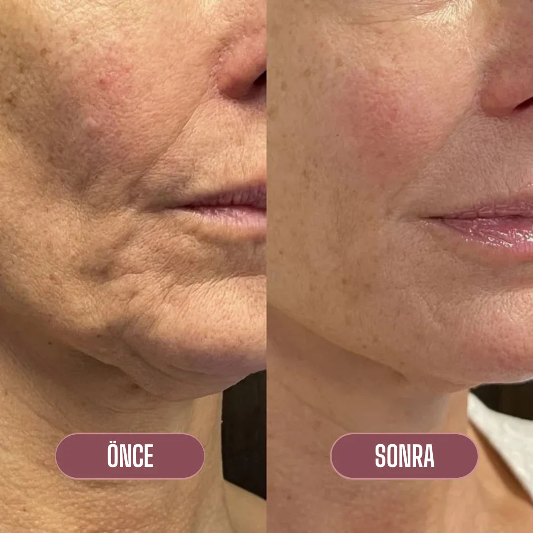 Lakerain Somon DNA'lı Gençleştirici Kolajen Stick