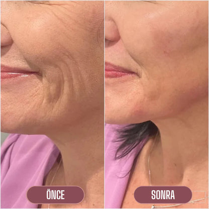 Lakerain Somon DNA'lı Gençleştirici Kolajen Stick