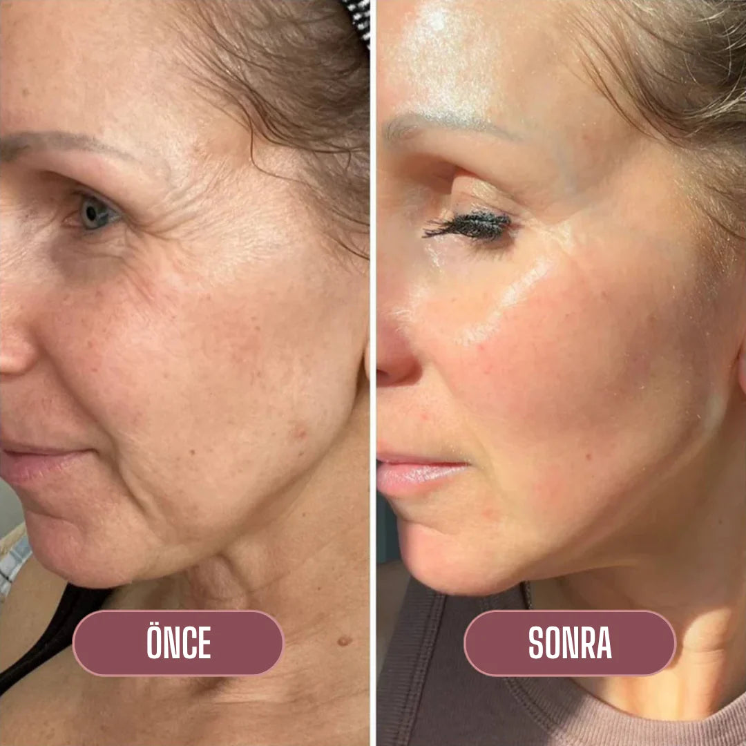 Lakerain Somon DNA'lı Gençleştirici Kolajen Stick