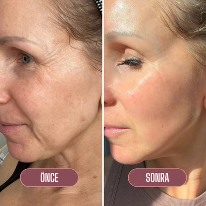 Lakerain Somon DNA'lı Gençleştirici Kolajen Stick