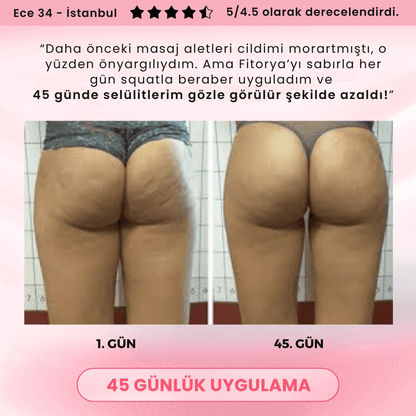 Fitorya Anti-Selülit Sıkılaştırıcı Masaj Aleti